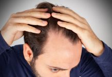 Understanding Hair Loss: The Basics