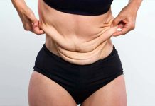 How to Avoid Loose Skin When Losing Weight