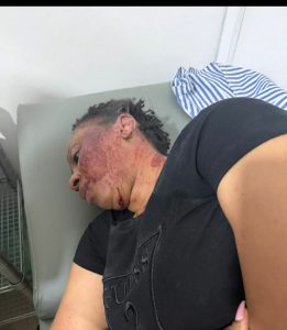 An injured Sarah Adwoa Sarfo lies in a hospital bed after an attack by armed men. Police allege the suspects are linked to her brother, Nana Akofera.