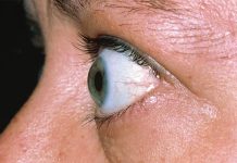 What Your Eyes Say About Your Health
