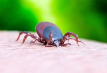 How Do You Remove A Tick?