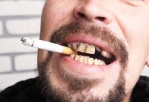 Smoking and Oral Health