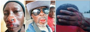 Police Probe Injuries To 5 Former Electrochem Workers